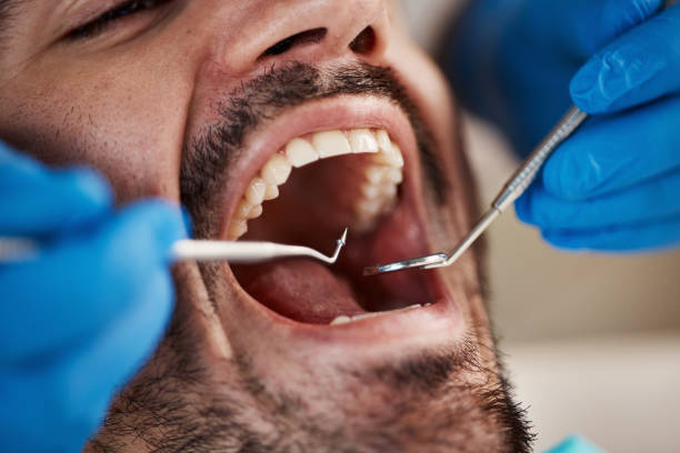 Best Weekend Emergency Dentist in Mcguire Af, NJ