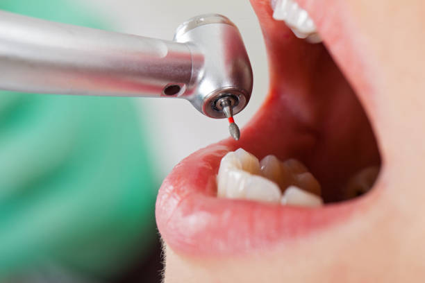 Best Emergency Root Canal Treatment in Mcguire Af, NJ